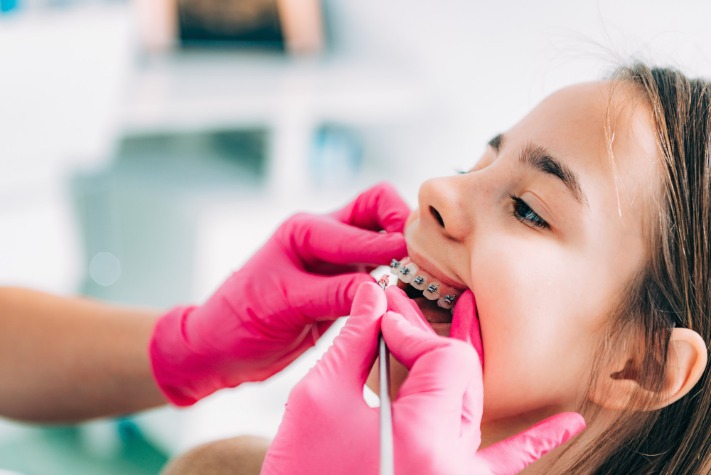 Get Your Perfect Smile with an Orthodontist in Adelaide